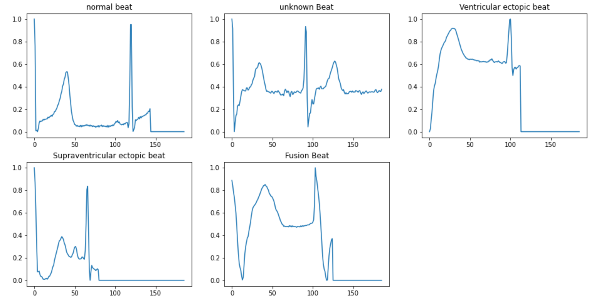 ECG Heartbeat Classification Model ML